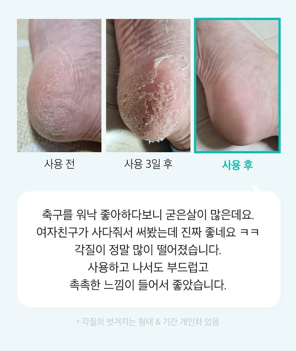 [발허물팩]아리얼 스무스앤퓨어 풋 필링 마스크 상세페이지 19
